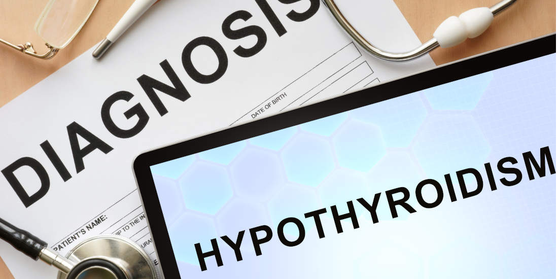 Ipotiroidismo: sintomi, cause e rimedi naturali